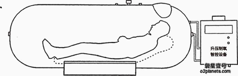 氧星壹号家用高压氧舱原理